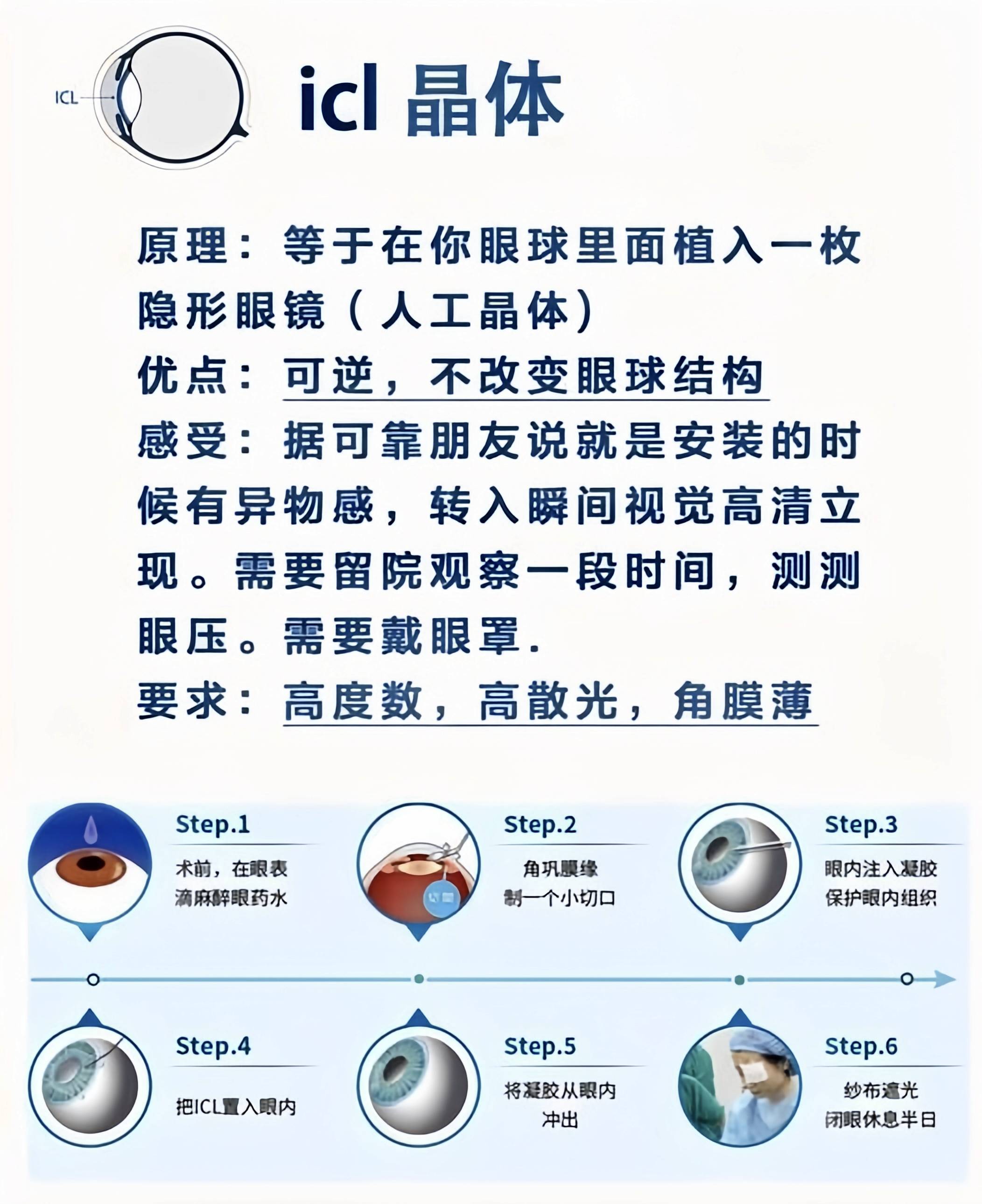 黑科技ICL晶体晚上看不清楚是为什么？聊聊这个让人又爱又恨的小东西